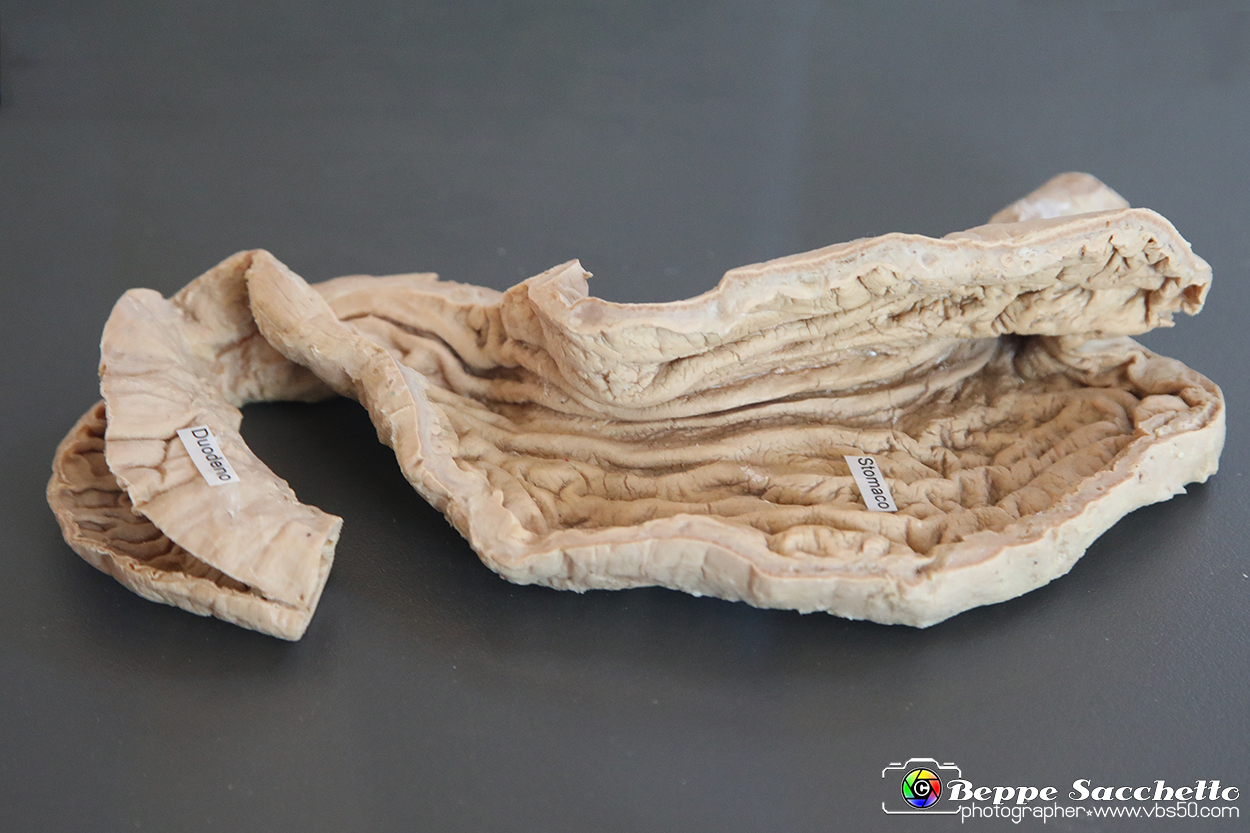 VBS_2766 - Stomaco. Mucosa gastrica - Mostra Body Worlds.jpg